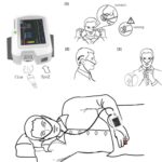 RS01 Patient Sleep Apnea Screen Meter Nose Air Flow Wrist Respiration Sleep Monitor Spo2 PR Alarm Nasal Cannula Record Software - Image 2